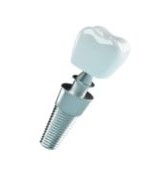 Dental Implants Shelby Township